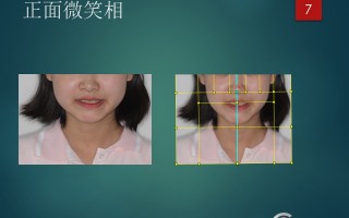 眼镜框不齐怎么调，眼镜框不齐怎么调整